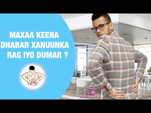 DHABAR XANUUNKA WAXA SABABO IYO SIDA LOOLA TACAALO Dr Faris Alattas