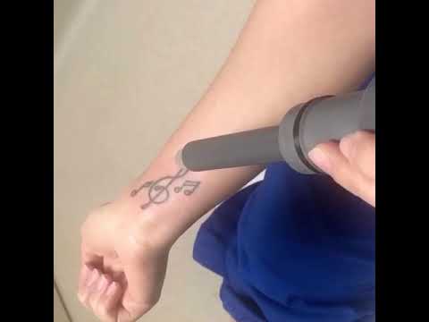 Laser Tattoo Removal El Paso TX  Cosmetic Laser Center