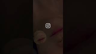 여드름, 흉터, 다모여라!! 다지워줄게!! 씨파우더 받고싶으면 지금 50%할인하니까 선착순 빨리 신청해요: 네이버: 새사명일고덕점 / 쿠폰발급 네이버 예약 필수 #강동구피부관리