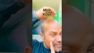Noyo mole ywting #shorts #youtubeshorts #cutfrom