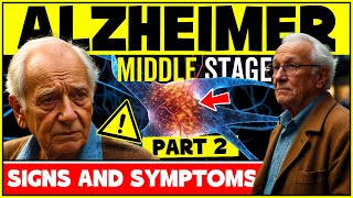 Signs And Symptoms Of Alzheimer's Disease In The Middle Stage - Alzheimer Symptoms - PART 2