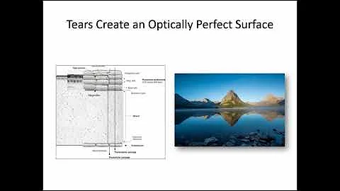 [Online Seminar] Arthur Epstein: Mastering Dry Eye...