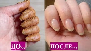 ШИКАРНАЯ МАСКА для роста и укрепления НОГТЕЙ. Достаточно 1-2 раза. ШИКАРНАЯ МАСКА для роста и укрепления НОГТЕЙ. Достаточно 1-2 раза.