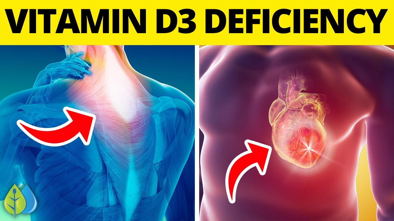  Top 14 Signs Of Vitamin D3 Deficiency You Need To Know YouTube