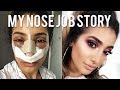 MY NOSE JOB SURGERY STORY AND VLOG - Cost and Experience