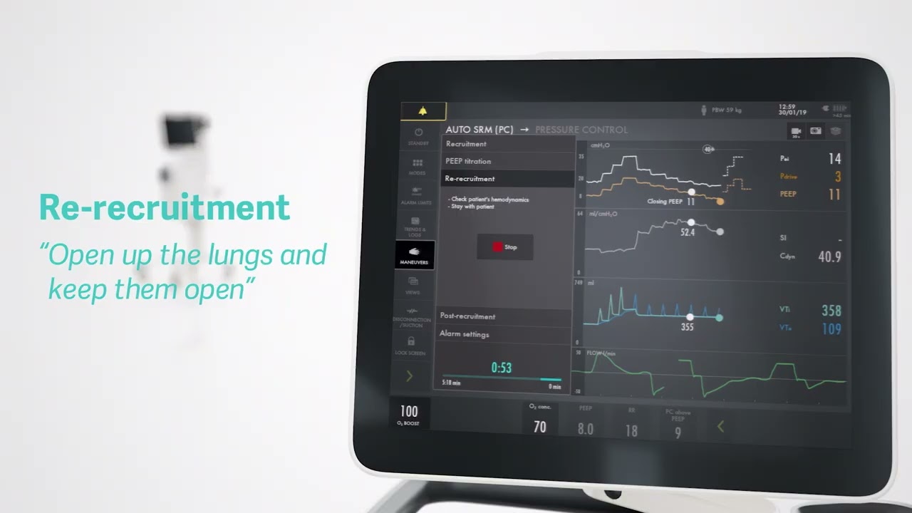 Getinge Servo-u 4.0 mechanical ventilator: Presenting personalized lung protection