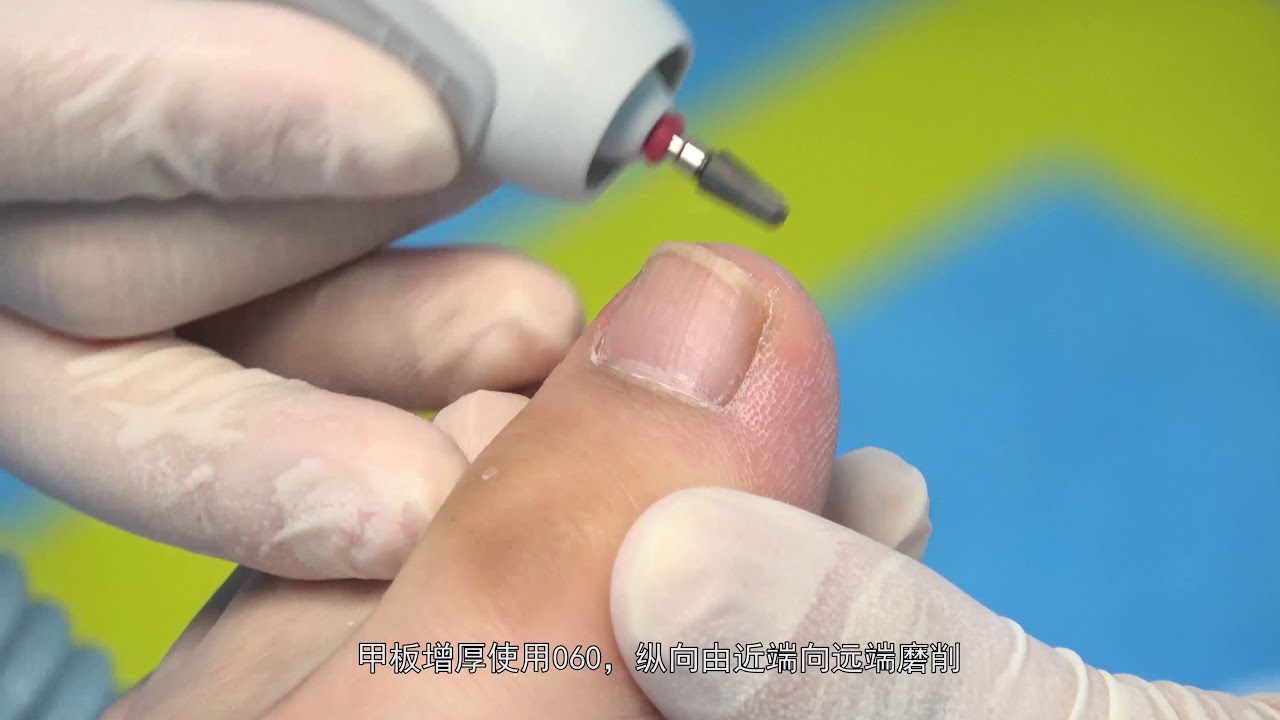 LUNA AT MICRO Instructions for use(月神打磨仪使用说明）