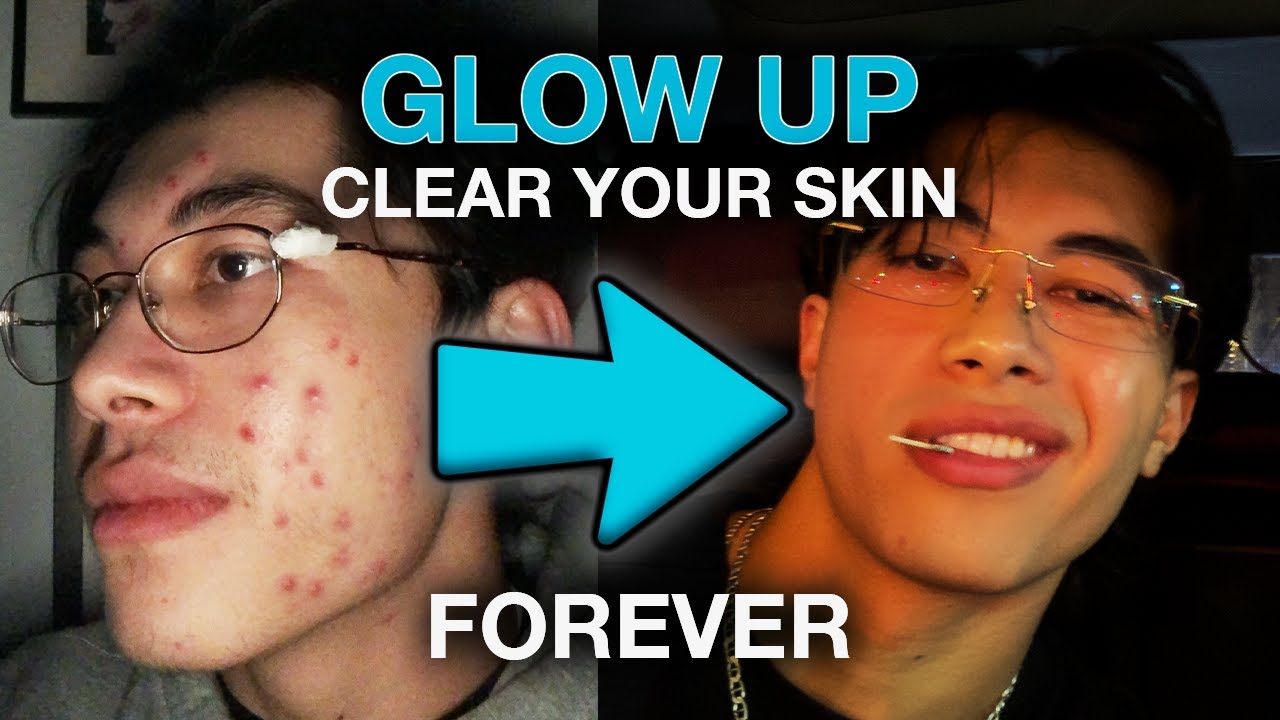 how to clear your skin & glow up forever (+ skincare routine) - YouTube