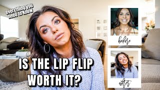 I got a lip flip | EVERYTHING YOU NEED TO KNOW ABOUT A LIP FLIP