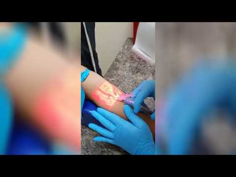 injection easy now