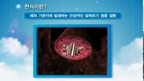 천식흡입제 사용법과 천식발작 응급대처법