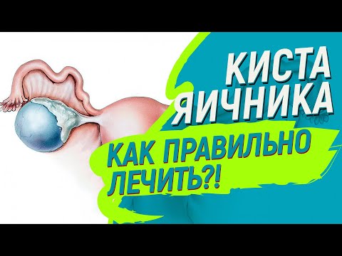 Видео: 3 способа естественного лечения боли при кисте яичника