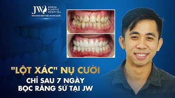 Nha khoa - "Lột xác" nụ cười chỉ sau 7 ngày bọc răng sứ tại JW