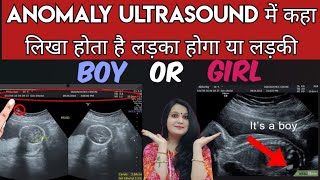 Anomaly ultrasound me kaha likha hota hai Boy hoga ya Girl || Gender prediction by anomaly scan