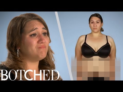 Crystal Wants "Botched" to Fix Her "Christmas Tree Tummy" | E!