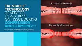 The Impact of Tri-Stapleᵀᴹ Technology on Tissue