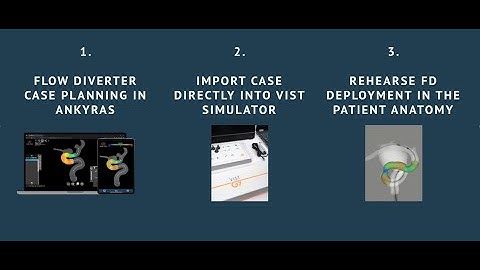 Exclusive access to the VIST® Ankyras® Flow Diverter Rehearsal simulation - Only on NV Connect
