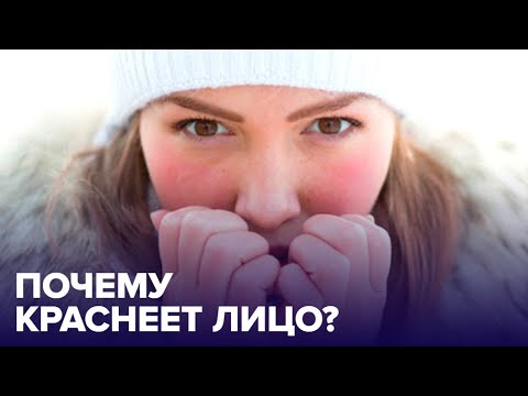 Почему КРАСНЕЕТ лицо? И как этого избежать?