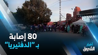 وزارة الصحة: تسجيل 80 حالة إصابة بداء الدفتيريا منها 16 حالة مؤكدة