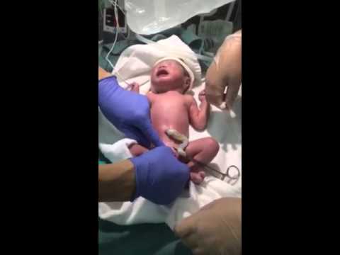 緊急帝王切開 出産の瞬間 赤ちゃん 男の子 ベビーbaby 2177g 出産の瞬間 Youtube