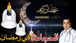 الحجامة في رمضان
