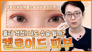 쌍꺼풀수술! 켈로이드 피부도 괜찮을까요?