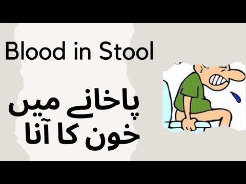 Blood in stool : پاخانے میں خون کا آنا : | urdu | | Prof Dr  Javed Iqbal |