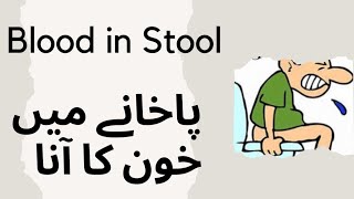 Blood in stool : پاخانے میں خون کا آنا : | urdu | | Prof Dr  Javed Iqbal | screenshot 1