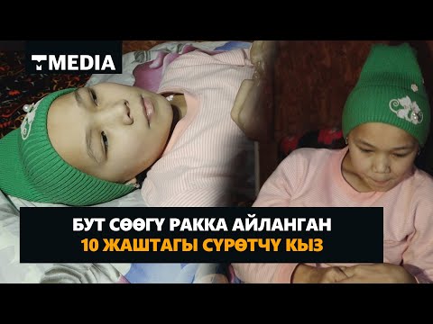 Video: Үйсүз Иса жана мөмө -жемиштер: чуулгандуу айкелдер адамдар азыркыга көбүрөөк чыдамдуу