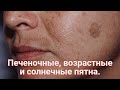 ПЕЧЕНОЧНЫЕ и ВОЗРАСТНЫЕ пятна, СОЛНЕЧНАЯ пигментация. Как убрать пигментные пятна с кожи? Рецепт.