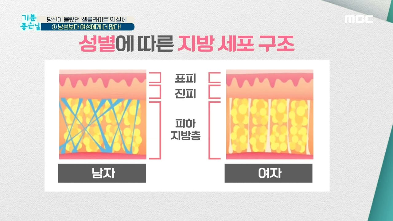 [기분 좋은 날] 남자에게는 셀룰라이트가 잘 생기지 않는다? 20200529