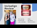 Invisalign Review: I&#39;M DONE + FAQ&#39;s, before/after photos, my advice, worth it? | Krengel Dental