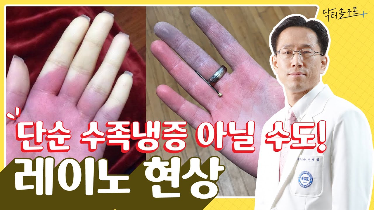 추운 날 손, 발가락 색 변하면 혹시? 원인질환 꼭 살펴야 하는 레이노 현상 | 닥터솔로몬