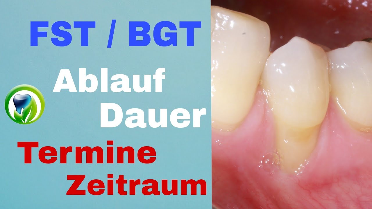 Freies Schleimhauttransplantat - Bindegewebstransplantat | Ablauf ...