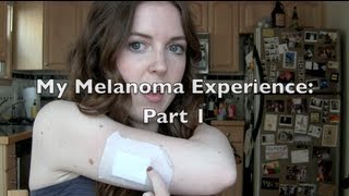 VLOG: Skin Cancer at 23? My Experience with Melanoma: Part 1 | chelsea wears