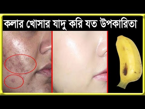 ভিডিও: আপনি কি কলার খোসা খেতে পারেন?