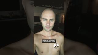 Новые средства от выпадения волос. ПРАВДА ИЛИ ОБМАН? #пересадкаволос #krasav4ik