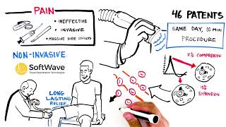 What is Softwave TRT? - An explanation of Extracorporeal shock wave therapy options.