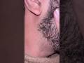 #haircare #salon #ingrownhairremoval #removeingrown #satisfying #oddlysatisfying #asmr#blackheads