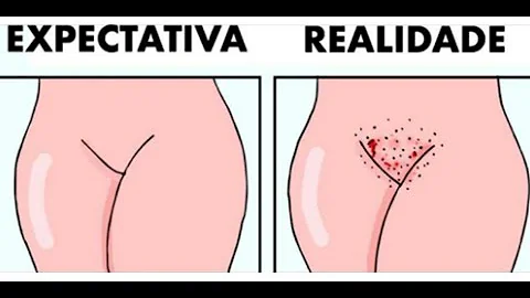 ¿Vuelve a crecer el vello de las partes íntimas?