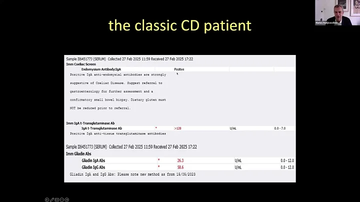All About Gluten Ataxia