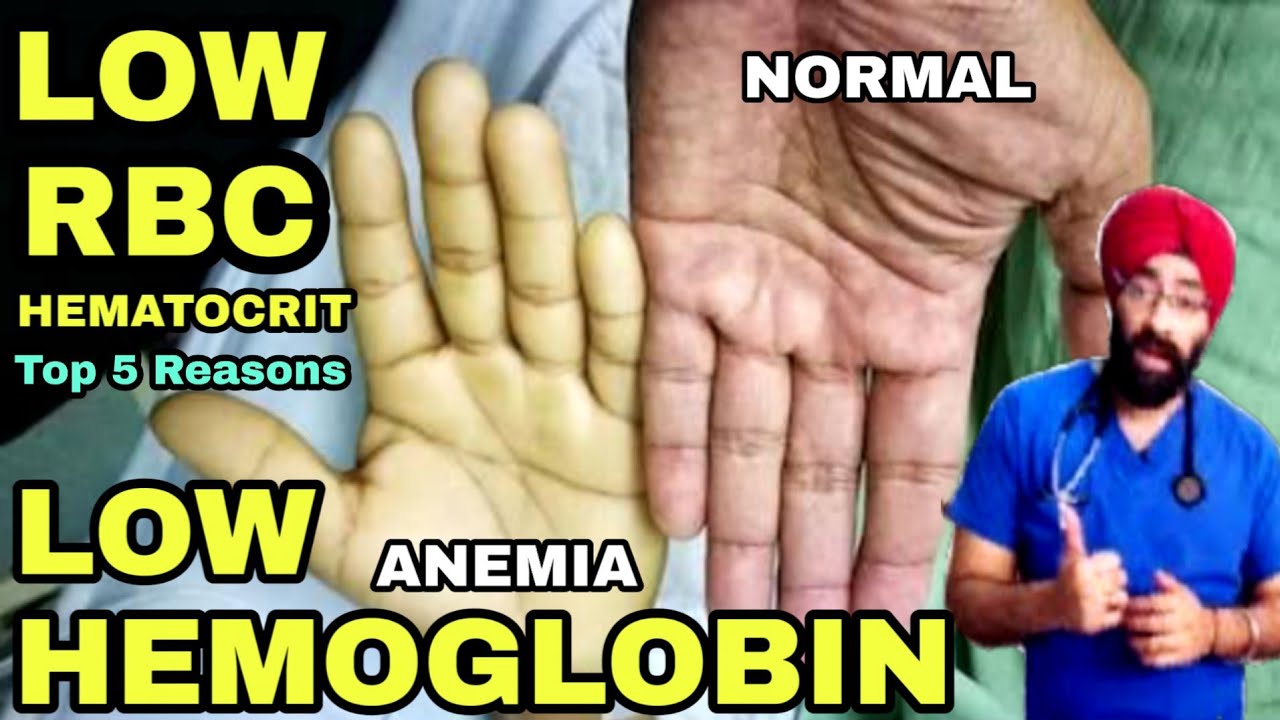 Top 5 Reasons For Low Hemoglobin Anemia Low Rbc Count Or Hematocrit