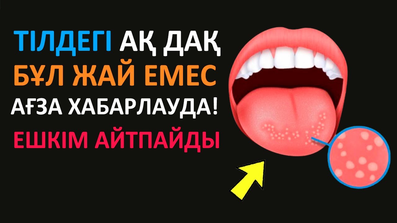 Орыс жетілген порно фото ру