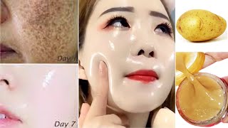 Japanese Secret To Whiten Skin 10 Shades | ល្អណាស់រូបមន្តបាត់ជាំមុខស | Remove Pigmentation & Melasma