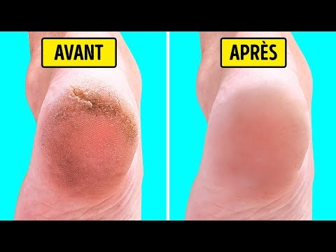 Vidéo: Comment Se Réchauffer Les Pieds Avec De La Moutarde