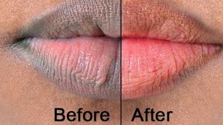 JINSI YA KUWA NA MIDOMO YA PINK MILAINI/HOW TO GET PINK LIPS(English subtitles)