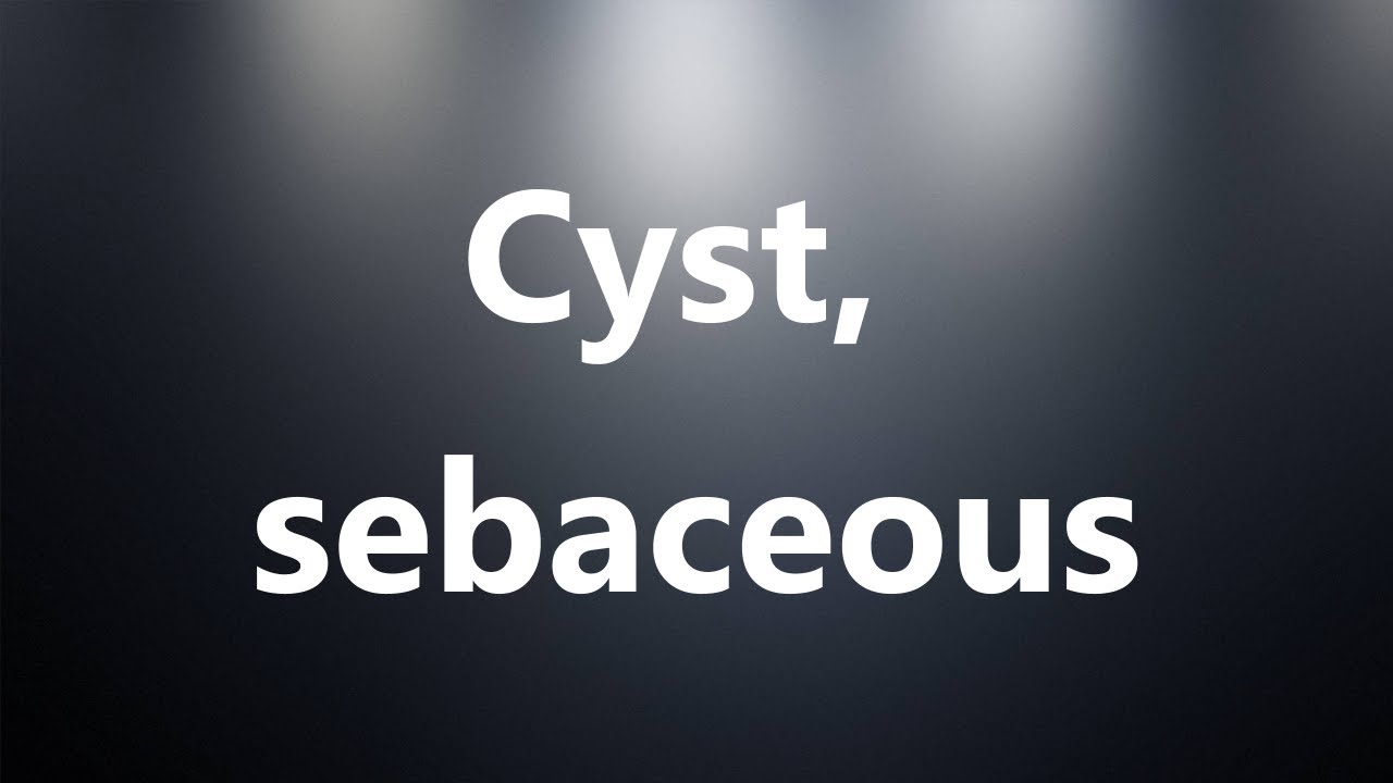 Cyst, sebaceous Medical Definition and Pronunciation YouTube