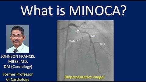 What is MINOCA?