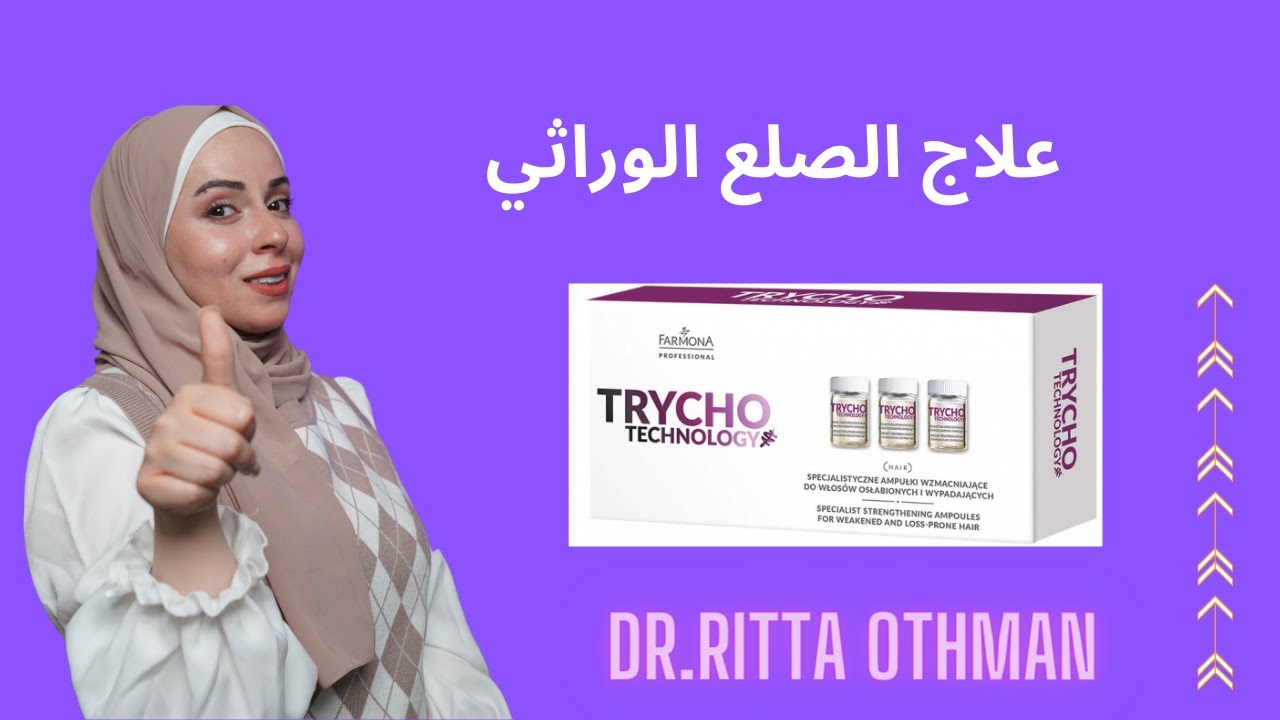 أفضل علاج للصلع الوراثي وتساقط الشعر | علاج الصلع | ميزوثيرابي للشعر