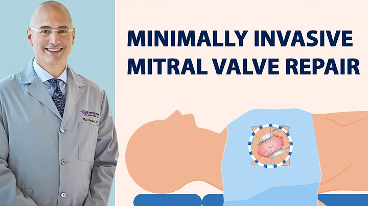 Surgeon Q&A: Minimally-Invasi...  Mitral Valve Rep...
